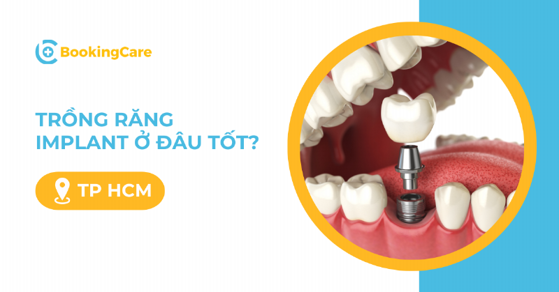 Nhổ Răng Sâu Hết Bao Nhiêu Tiền? Bảng Giá Chi Tiết 2024